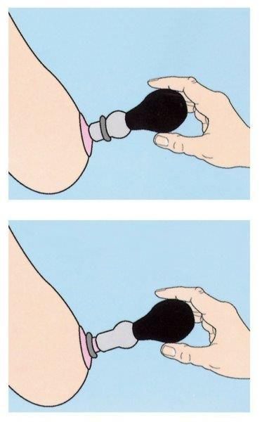 Вакуумні стимулятори для сосків Nipple Pump 10 Piece Set